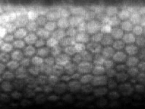 戸塚モディ眼科の「コンタクトレンズ」画像