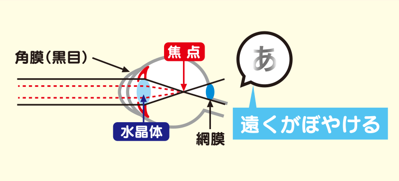 戸塚モディ眼科の「目の病気」画像