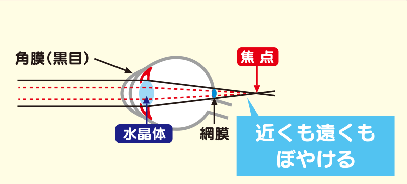 戸塚モディ眼科の「目の病気」画像